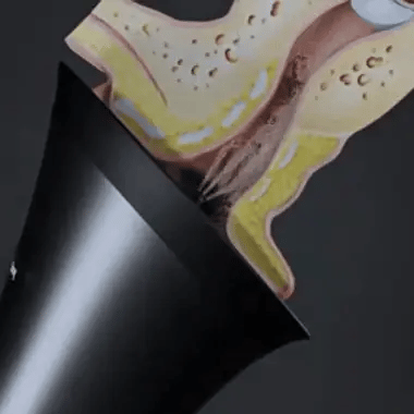 Zevra™ Electric Ear Wax Removal Kit